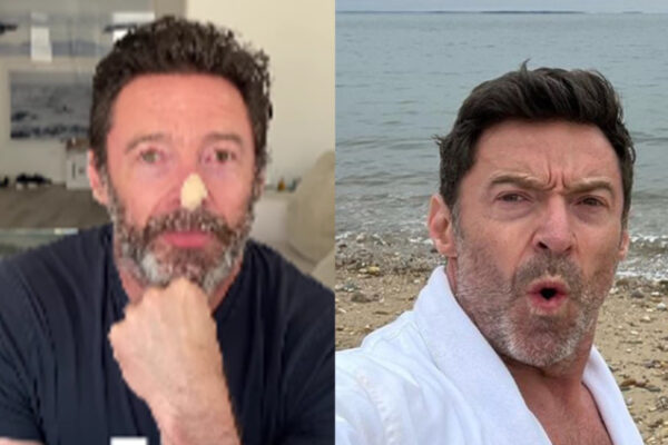 Cáncer de piel acecha a Hugh Jackman