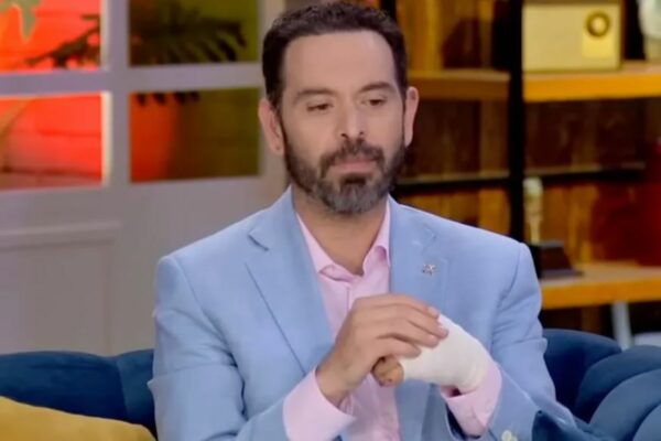 Lalo Carrillo, conductor de ‘De Primera Mano’, sufre accidente en moto y se rompe la mano