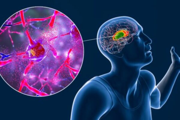 Investigadores ingleses desarrollan nueva inyección para la enfermedad de Huntington