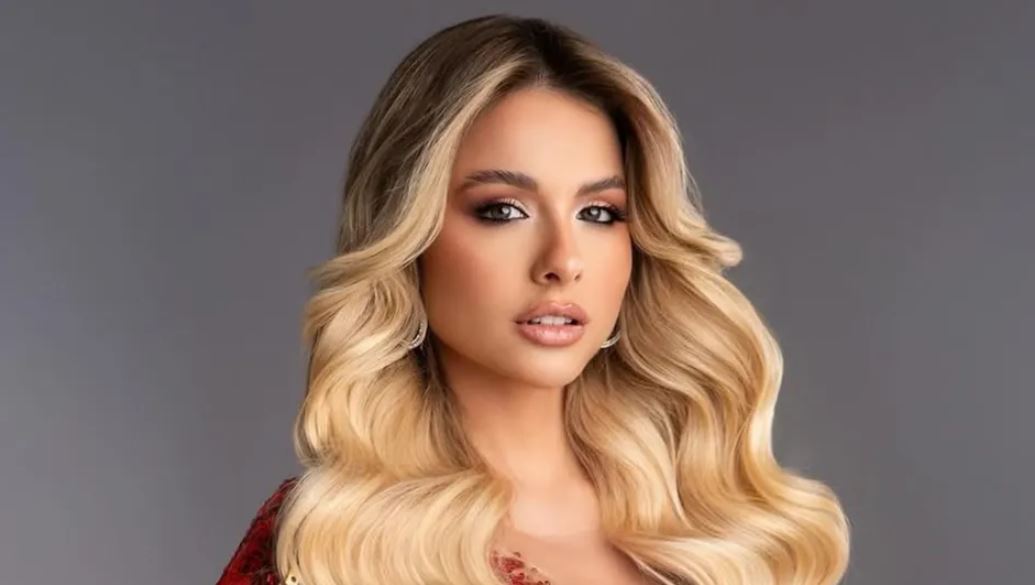 Miss Universo Argentina tiene alopecia; muestra la zona donde no le crece cabello: “Todos tenemos imperfecciones”