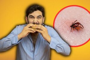 Hombre pierde la vida por comer una hamburguesa; una garrapata fue la responsable