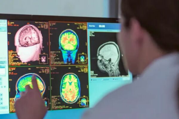 La adolescencia dura hasta los 32 años, según un nuevo estudio