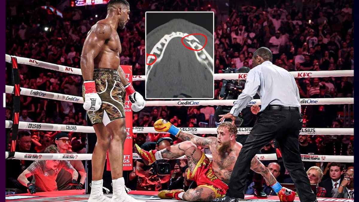 Jake Paul termina con doble mandíbula rota y desafía a Canelo ¡en 10 días!