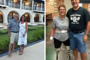 Mujer pierde brazos y piernas tras infección causada por su perro: “fue el peor día de mi vida”