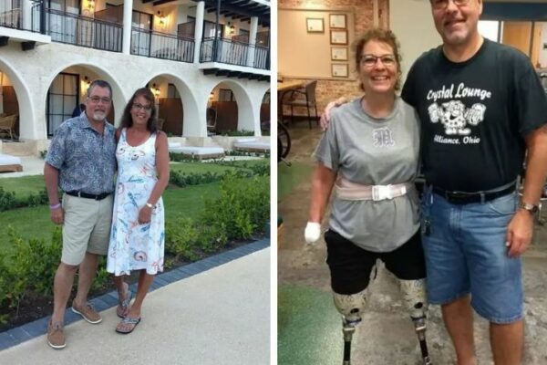 Mujer pierde brazos y piernas tras infección causada por su perro: “fue el peor día de mi vida”