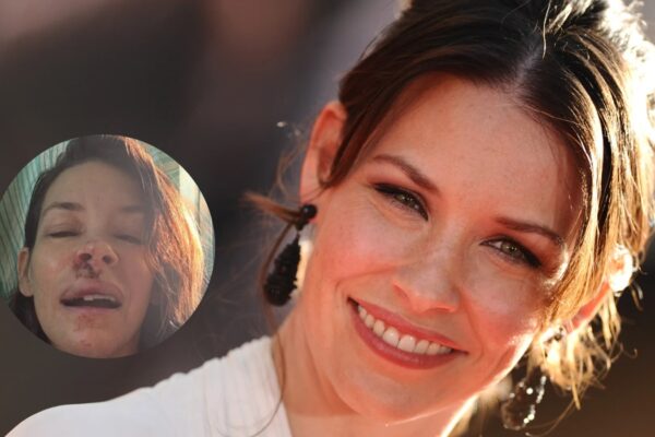 Evangeline Lilly revela daño cerebral tras sufrir un traumatismo craneoencefálico