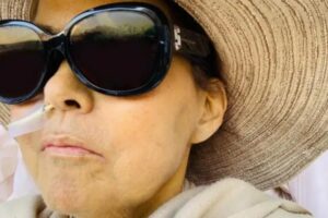 Mujer perdió casi 30 centímetros de estatura por esta extraña enfermedad