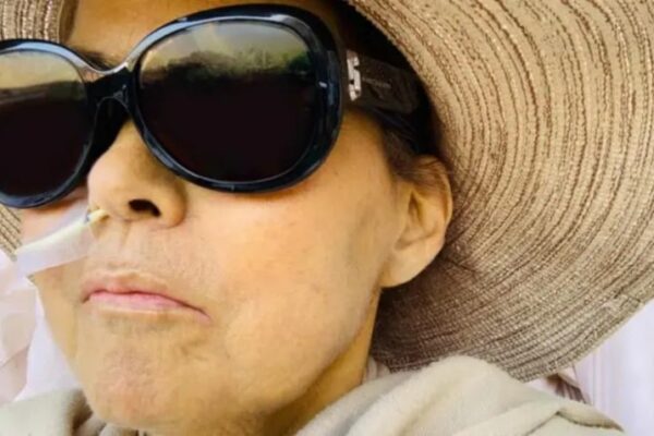 Mujer perdió casi 30 centímetros de estatura por esta extraña enfermedad